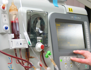 dialysis-machine1
